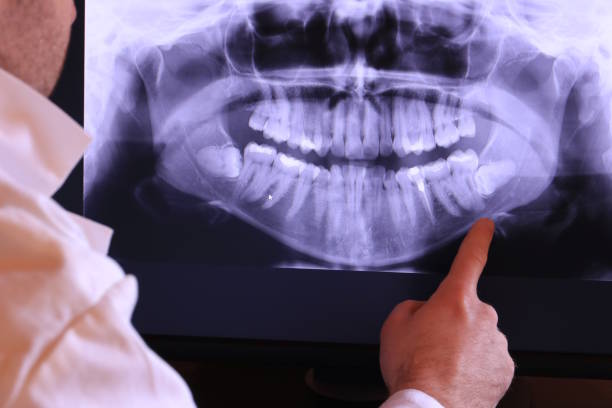 Best Emergency Dental Care for Broken or Chipped Teeth in Arden Hills, MN