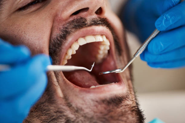 Best Emergency Gum Treatment in Arden Hills, MN